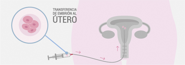transferencia de embriones