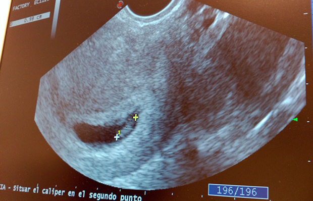 “Nos han dado la alegría de nuestra vida, un hijo, y se lo debo todo a ellas” “Nos han dado la alegría de nuestra vida, un hijo, y se lo debo todo a ellas”
