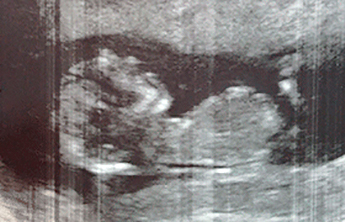 “Lo que me viene en camino es un niño… ¡estamos deseando verlo!” “Lo que me viene en camino es un niño… ¡estamos deseando verlo!”