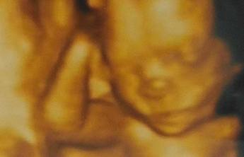 «¡Mi pequeño milagro!» «¡Mi pequeño milagro!»