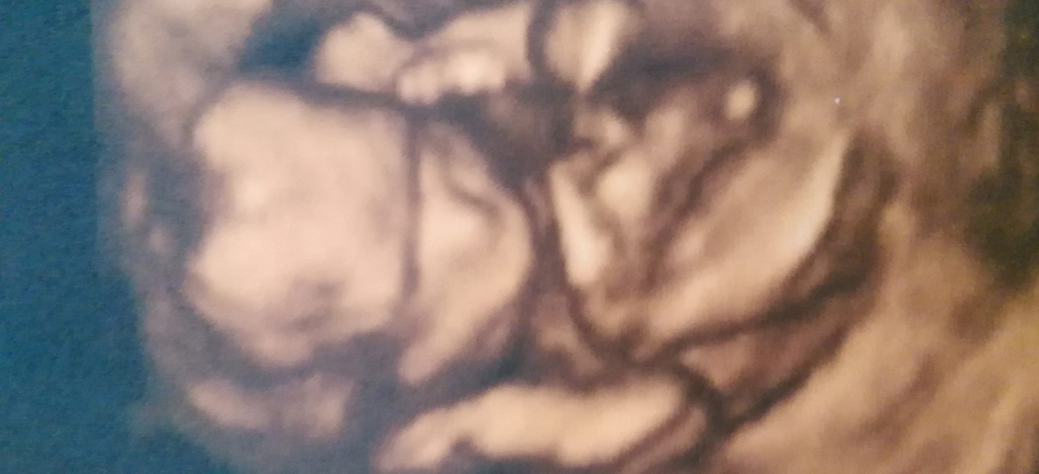 testimonio fertilidad