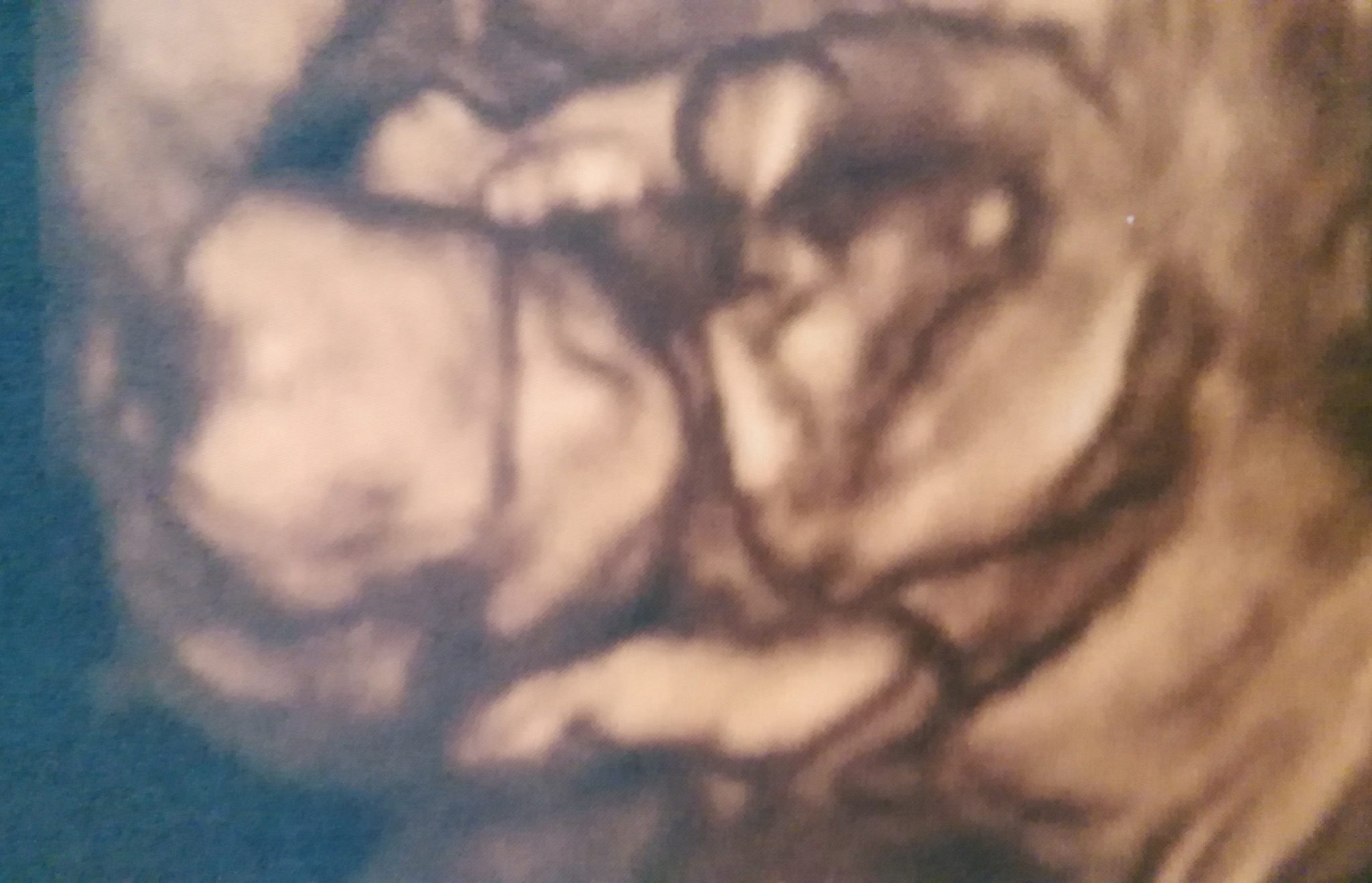«Gracias a Clínicas EVA, mi pareja y yo estamos de 16 semanas» «Gracias a Clínicas EVA, mi pareja y yo estamos de 16 semanas»