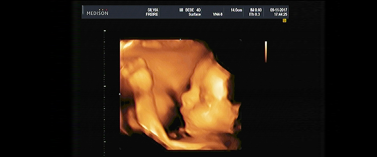 Testimonio clínicas de fertilidad eva
