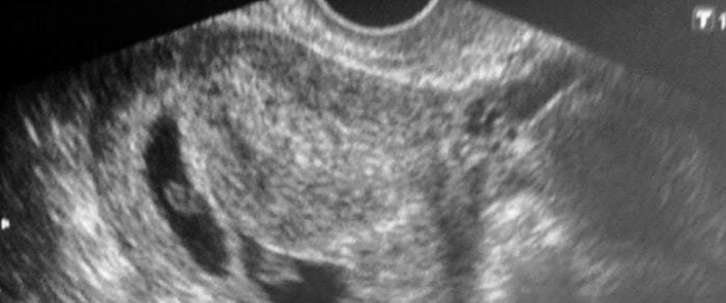Padres de mellizos a la primera Padres de mellizos a la primera