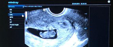 Estoy embarazada de 3 meses Estoy embarazada de 3 meses